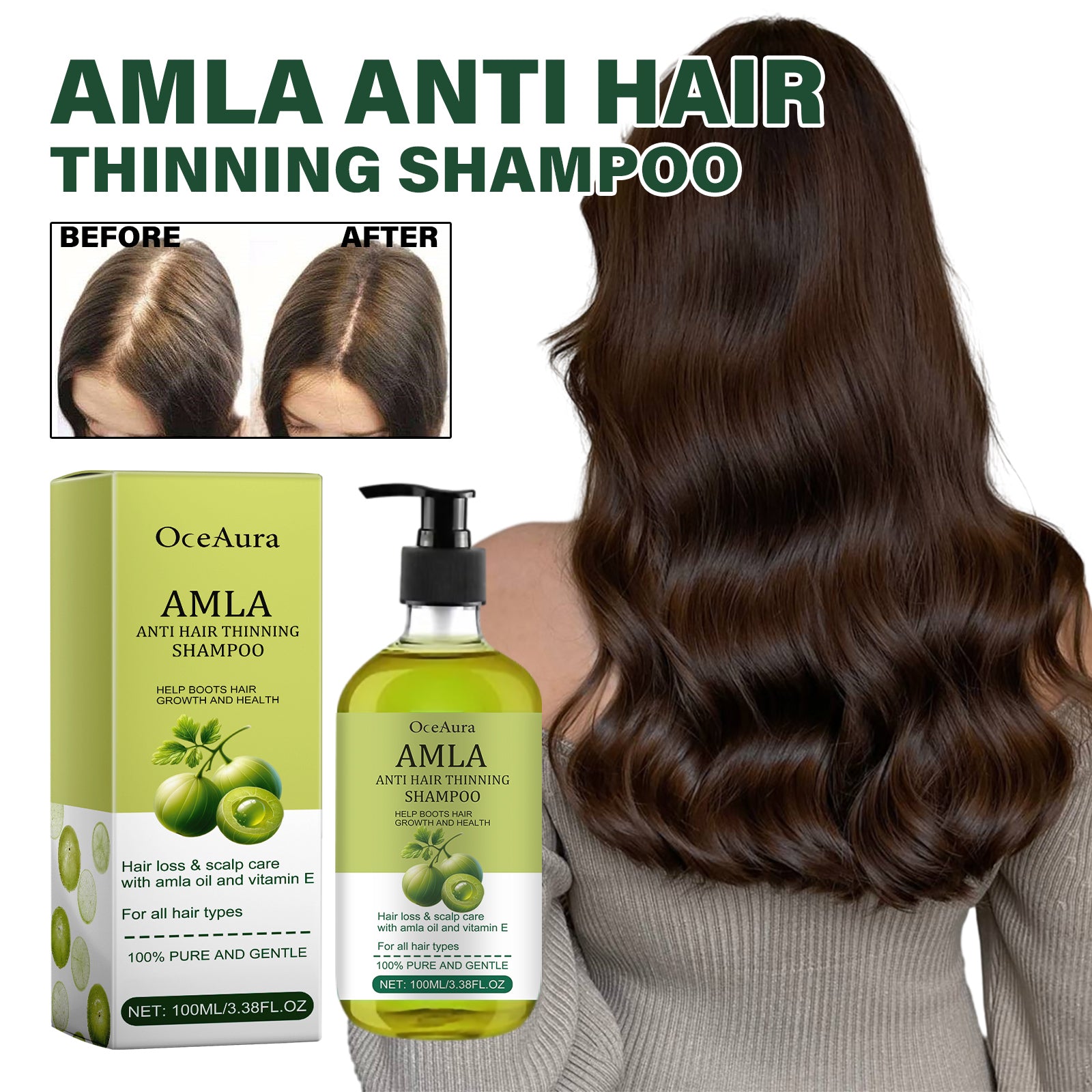 Champú Anticaída de Amla